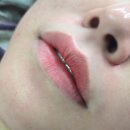 생기(여자) | 청라입술 잘하는곳 벨로도트 통증 없는 생기입술관리