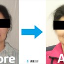 세움치과기공소 이미지