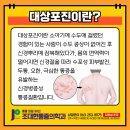권통증의학과
