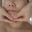 해미모터라인 | 리프팅맛집 예쁠미에스테틱 온다 리프팅 10만줄 후기