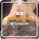 웰킨두피탈모센터 | 강남탈모·두피관리 웰킨두피탈모센터 후기