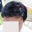 명품가발 네이버블로그