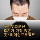 리게인프로젝트 상봉점 | 구미두피문신 후기가 가장 많은 곳? 리게인프로젝트 대구본점 두피문신의 시작