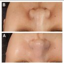 셀럽바디 | 대조동 피부관리 추천 셀럽 뷰티어겐 재생관리 바디케어 솔직후기