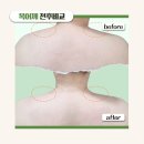 미옥에스테틱 | 허리불편함 등결림 승모근뭉침 풀어주는 울산 우정동 등관리