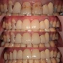 부평센트럴치과의원 이미지