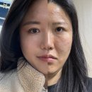 진자솝 | 30대 여자 만성 성인 여드름 피부 외모정병으로 탈출피부과시술+올리브영 추천
