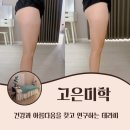 정관한의원 | 정관마사지 기장 고은미학에스테틱 솔직후기 - 하체관리 전,후 사진 보고 깜짝!