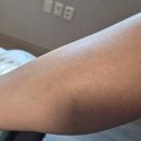 (주)유케이 | 등드름은 유케이스크럽으로 고민해결! 등드름 없애주는 유케이스크럽 후기👍