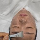 한올랜드(주) | 송도 주솜에스테틱 피코슈어 닥토필앰플 기미,잡티 관리 솔직후기 ✨