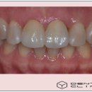 동의치과기공소 이미지