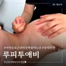 루피투애비