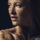 셀린의원 네이버블로그