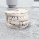 강서하늘치과의원 | 마곡동치과_ "불편함은 잠시, 꿀잠은 오래!" [ 2. 코골이 장치 사용 후기와 적응법 ]