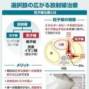 암에 대한 입자선치료란 어떤 것인가？…보험진료가 되는 대상 넓어진다 이미지