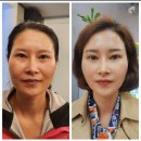 라온인셀덤 네이버블로그