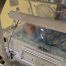 복덩이침구방 | 창원경상대병원 제왕절개 3박 4일 입원 수술 후기(1일차) : 주차, 입원비, 준비물