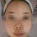 핑크뷰티 | 포항 피부관리 철길숲 핑크뷰티 꼼꼼 얼굴관리 후기