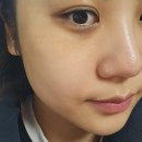 롬프란 스킨앤바디 이미지