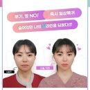 진피부사랑
