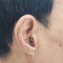 잘못 착용한 보청기도 바로 잡아주는 친절함! 광진구보청기 전문 <굿모닝보청기광진센터> 후기