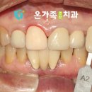 수연합치과기공소 네이버블로그