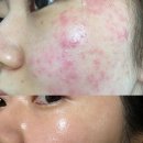 미주약국 | 비반콴트망카 로션 재생크림 6개월 사용 후기