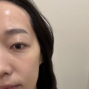 서산 피부관리 더온결에스테틱 도테라천연오일테라피 관리 후기