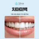 하얀고운치과의원 네이버블로그