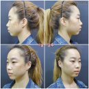 압구정리더스피부과의원 네이버블로그