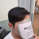 마이크로헤어증모