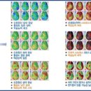 굿모닝메디칼 이미지