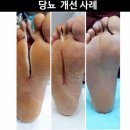진크린 이미지