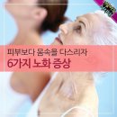 피부보다 몸속을 다스리자! 6가지 노화 증상 이미지