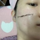 전주 왁싱 송천동 킴벨리뷰티 스킨플래닝, 사후관리까지 완벽해요