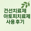 (주)금강E&D경산점 | 건선치료제 사용한 4명 후기 / 아토피치료제 사용한 4명후기