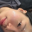 봉산동 피부관리 솔에스테틱 대구점 여드름 관리 솔직후기