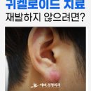 귀염증 귀뚫고염증 진물 왼쪽 귀통증 피어싱 귀고름 정리! 이미지