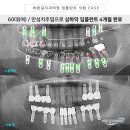 상하치과의원 네이버블로그