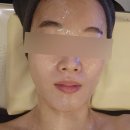 동안라인스킨케어 | 포항피부관리 더휴스킨케어 싸이블로 얼굴라인 관리 후기
