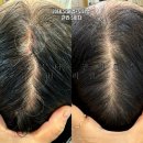 뚜레쥬르향남성지점 | 향남두피관리 두피순환관리 솔직후기 - H.리셀 향남점