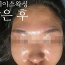 모던김밥스페이스본 | 홍대 풀페이스왁싱 마벨왁싱 홍대점에서 솜털제거로 화잘먹 피부 완성한 후기