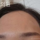 수앤미피부과의원 네이버블로그