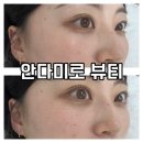 석전동204 | 마산 속눈썹펌 잘하는곳 유명한 석전동 안다미로뷰티