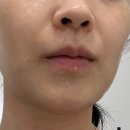 모해인셀덤 | 군산 수송동물광피부는 인셀덤퀸 군산점에서