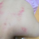 인천서구 피부관리 샤플리뷰티 승모근관리 후기