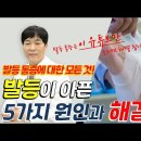 발등통증,발목통증에 신박한 분석과 신통한 해결법/발등부종,류마티스관절염,통풍,발등통증 운동법 이미지