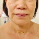 미진뷰티 | 피부가 반짝이는 비밀, 미진뷰티의 특별한 일산피부관리 후기
