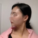 💖 처진 볼살 정리! 세 가지 동시에