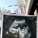 세민식당(옥이네숯불구이) | 👶🏻임신후기 일상 마지막(출산 D-1!, 26년 2월~3월)